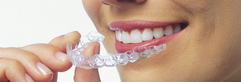 aorati orthodontiki2